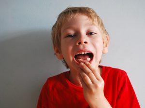 prevenzione dentale per bambini e ragazzi